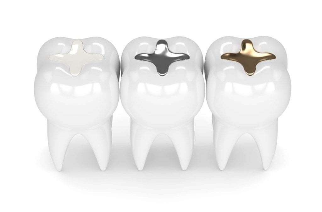 Recommendations for Certain High-Risk Groups Regarding Mercury-Containing Dental Amalgam